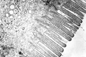 epitelio con microvellosidades